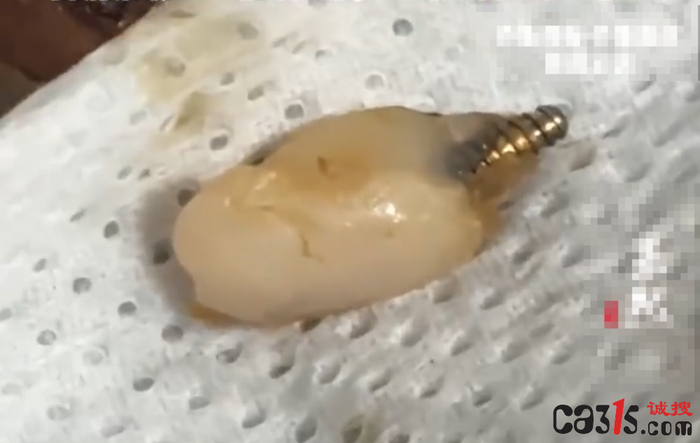 山姆蛋糕吃出疑似牙齿异物引广泛关注 客服称已反馈工厂排查(图2) QQ20251015-095451.png